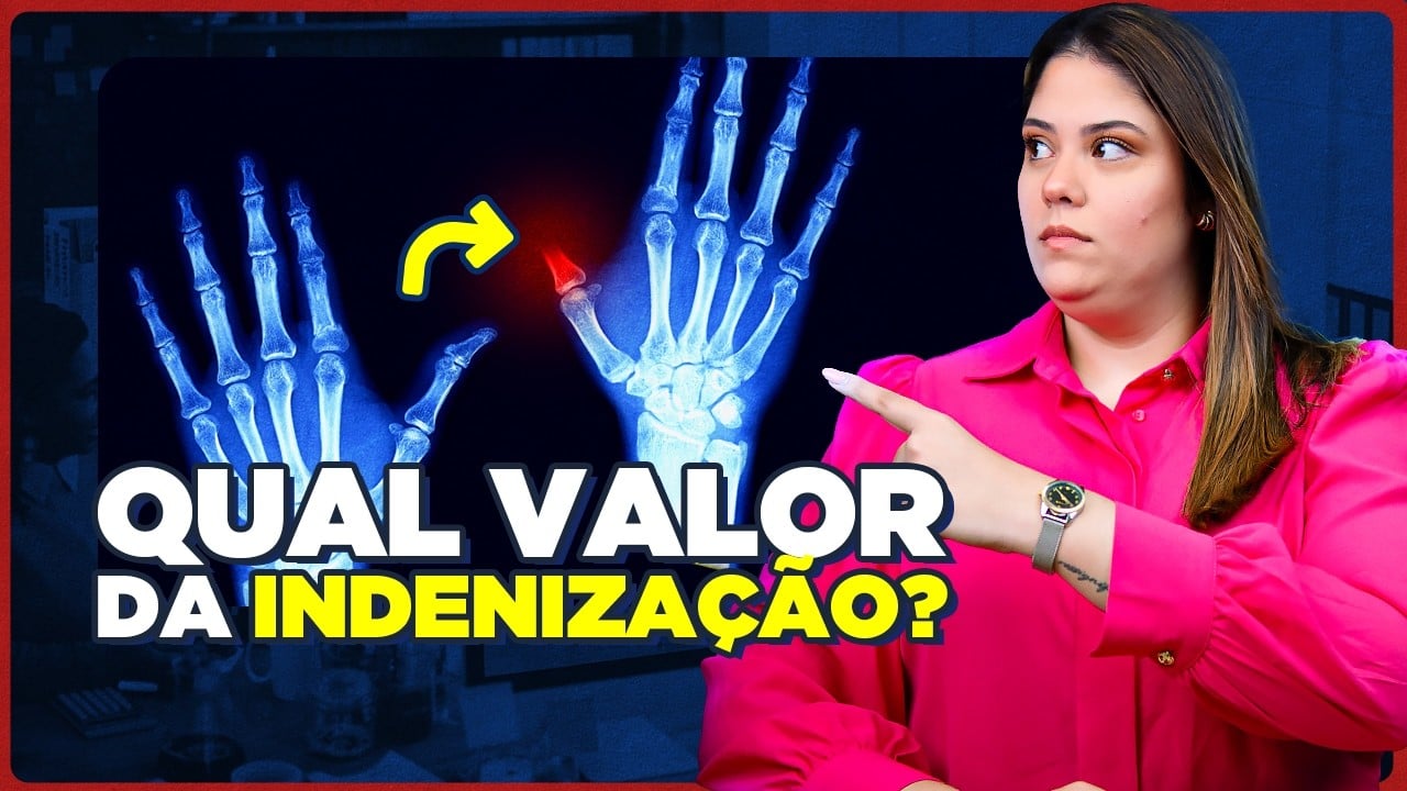 Valor da INDENIZAÇÃO por Perda de Dedo da Mão em 2025 (atualizado)