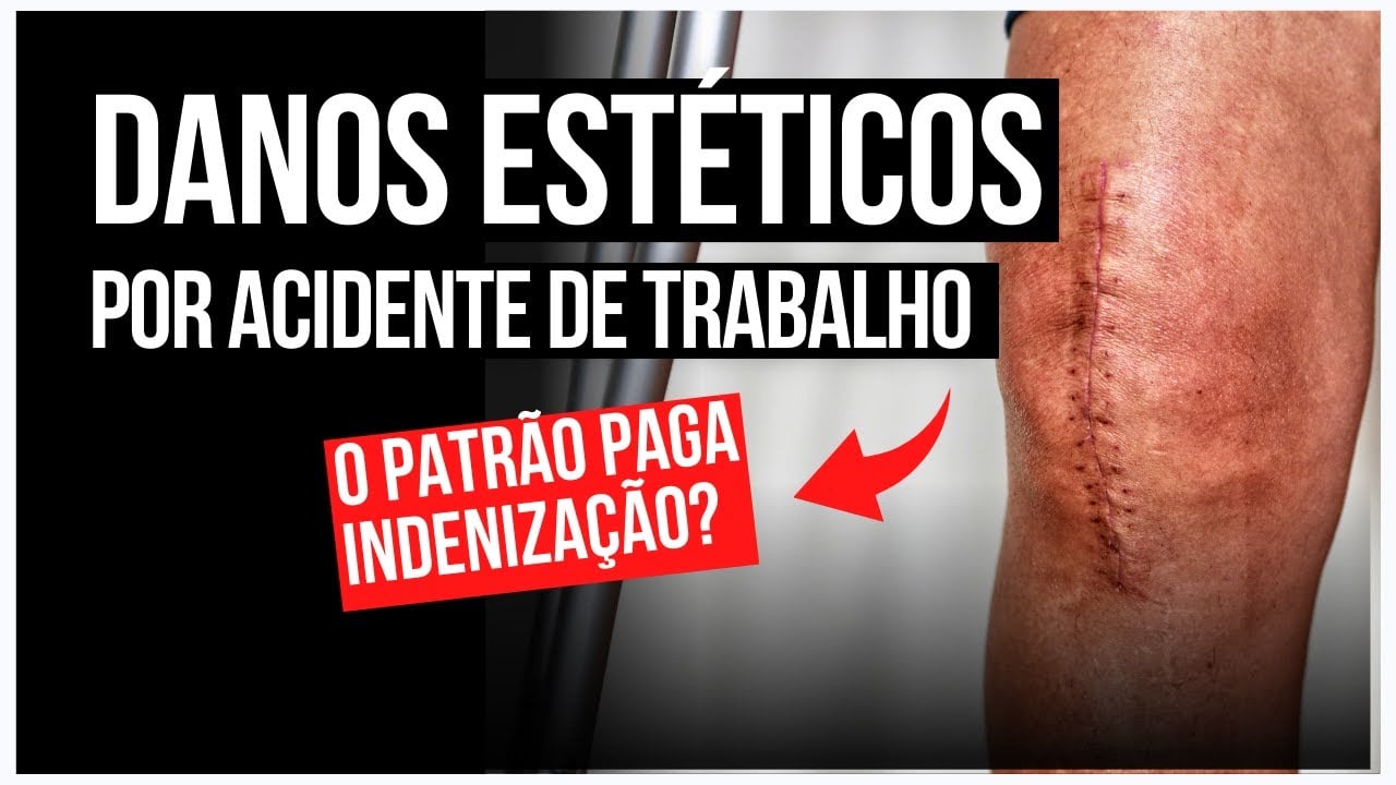Danos estéticos por acidente de trabalho