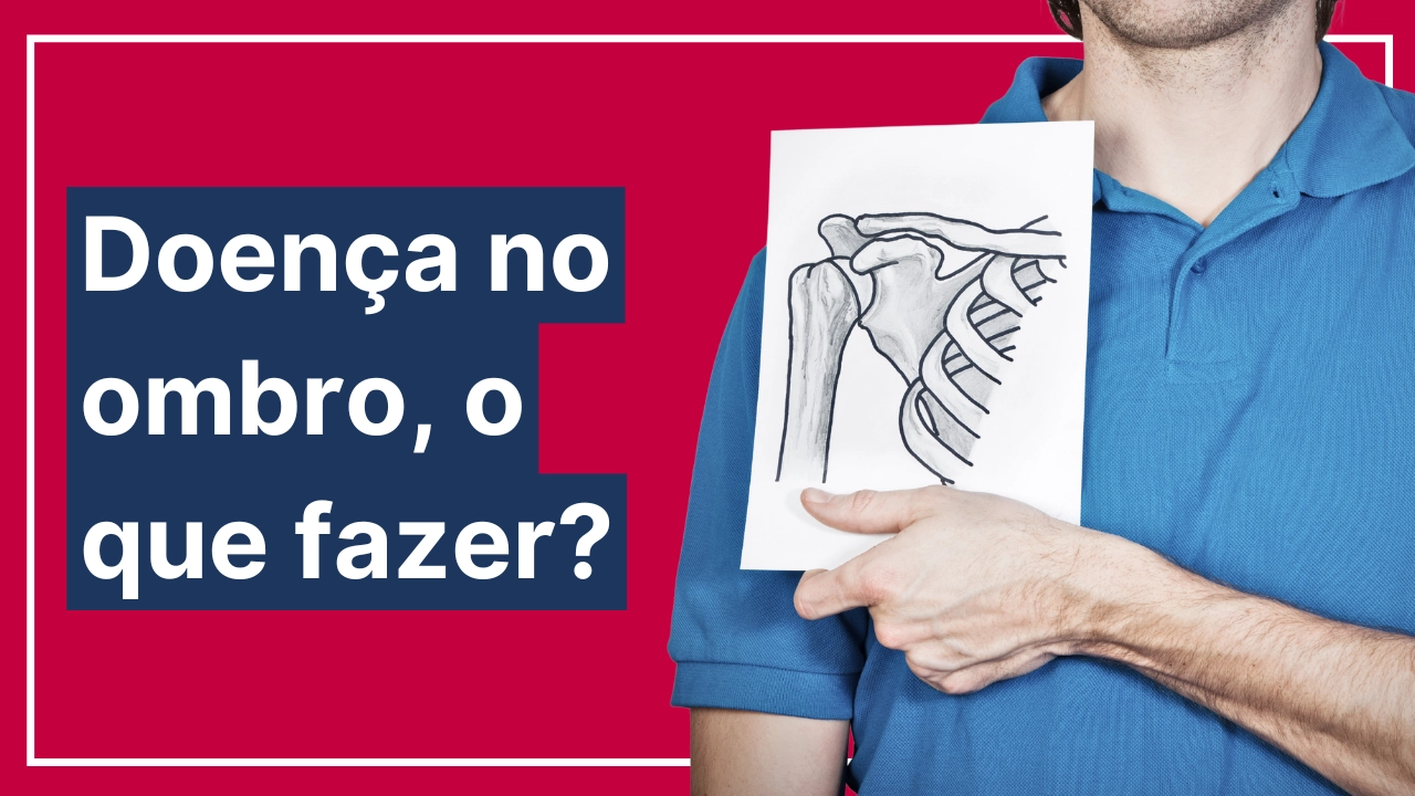 Saiba o que fazer após desenvolver problema no ombro por causa do trabalho