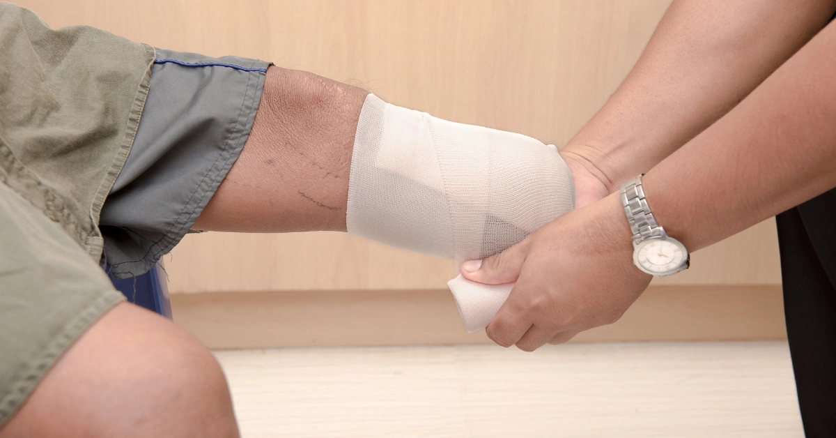 Direitos após Amputação por acidente de trabalho